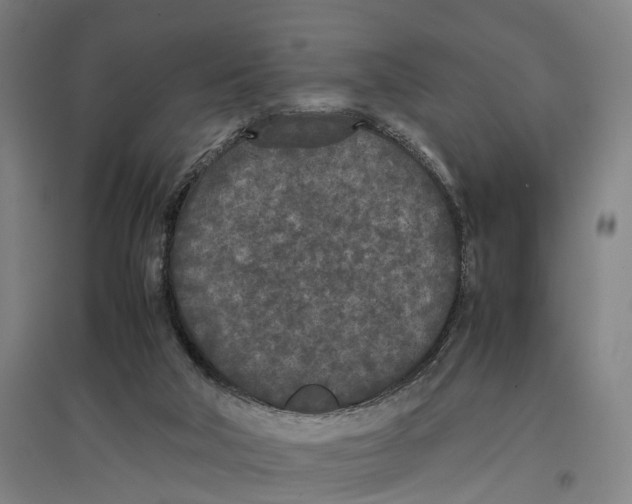 X0000096650018200803041159