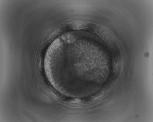 X0000096650219200803041156