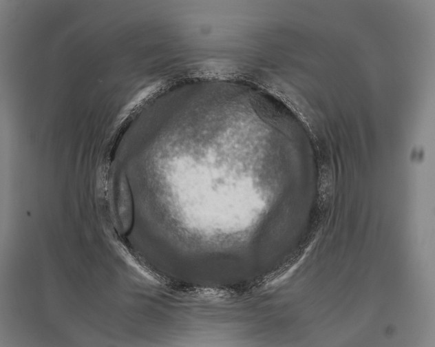 X0000096650585200803041151