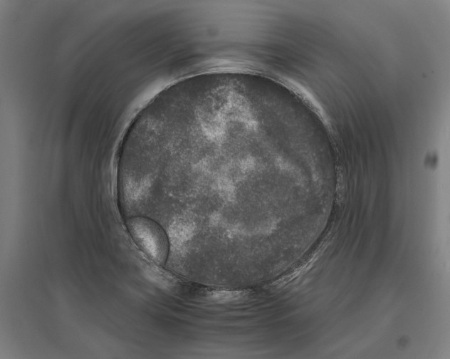 X0000096651419200803041139