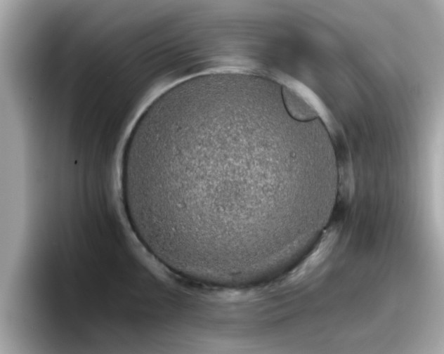 X0000096661099200802121125