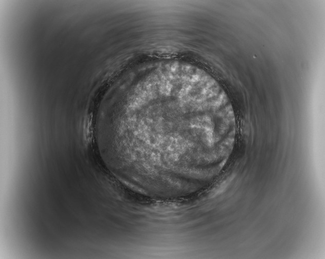 X0000096660818200802261340