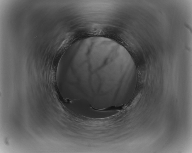 X0000096660035200803041210