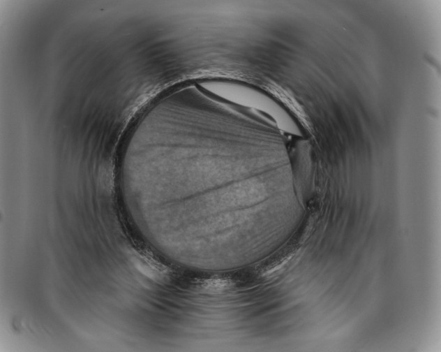 X0000096660204200803041207