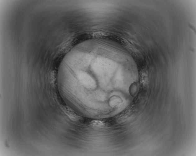 X0000096660519200803041203