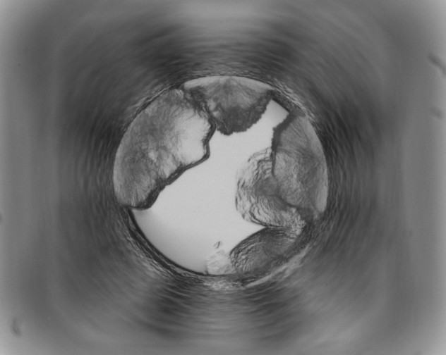 X0000096660545200803041203