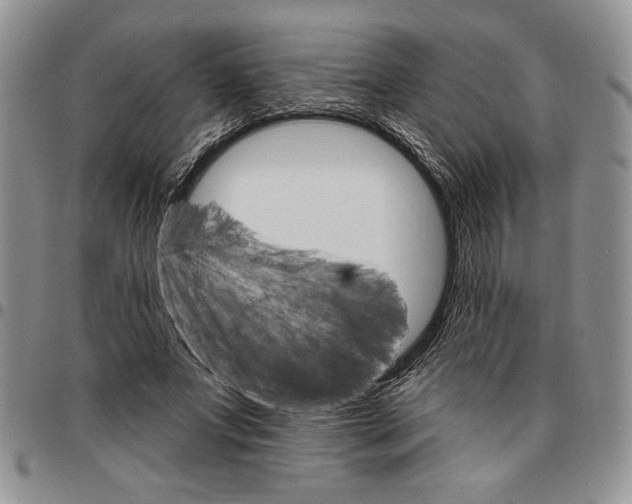 X0000096660687200803041201