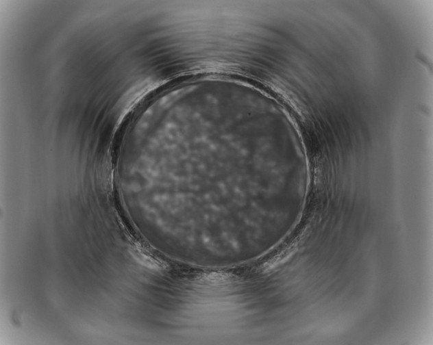 X0000096661117200803041155