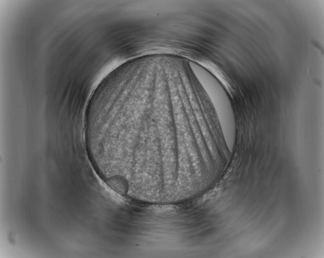 X0000096661143200803041155