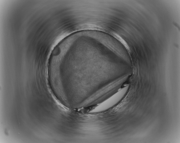 X0000096661144200803041155