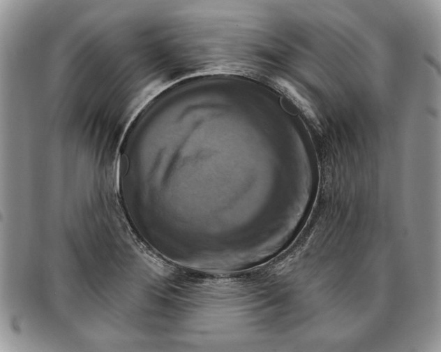 X0000096661276200803041153