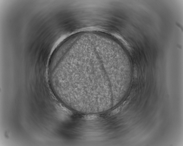 X0000096661278200803041153