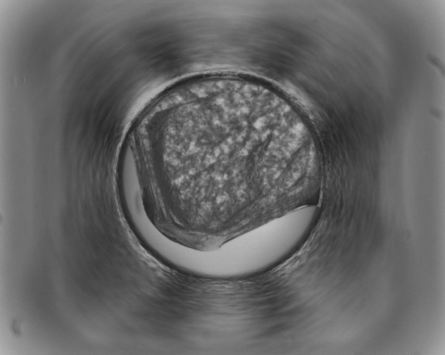 X0000096661279200803041153