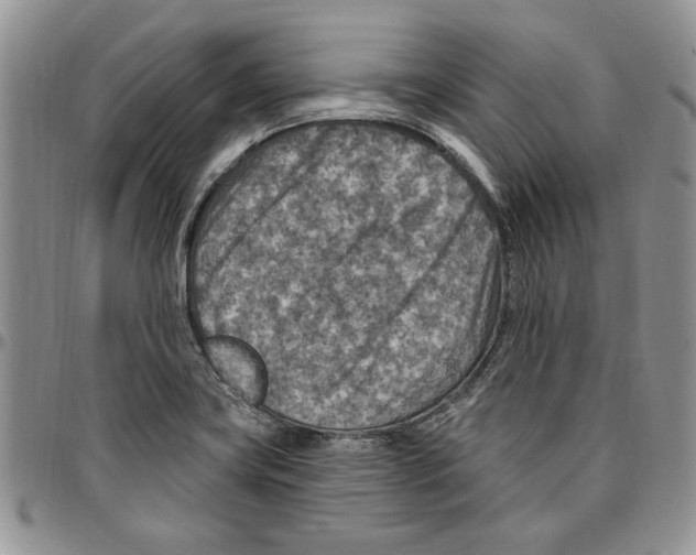 X0000096661419200803041151