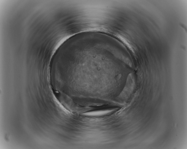 X0000096661468200803041151