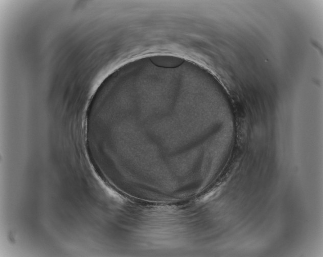 X0000096661519200803041150