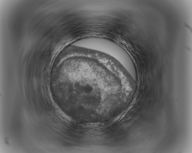 X0000096670049200803041229