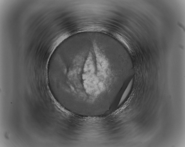 X0000096681087200802191347