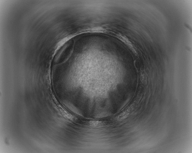 X0000096681176200802191346