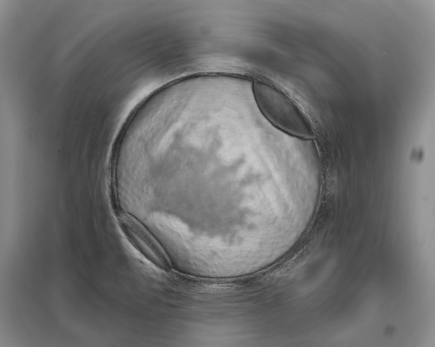 X0000096681471200802261504