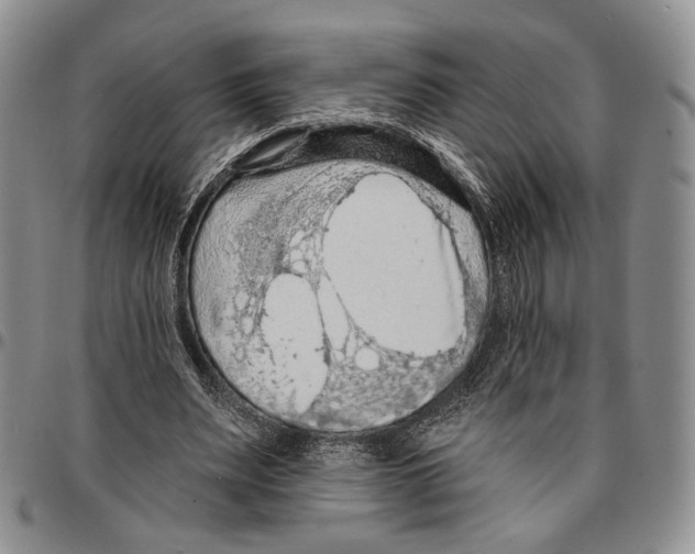 X0000096680487200803041243