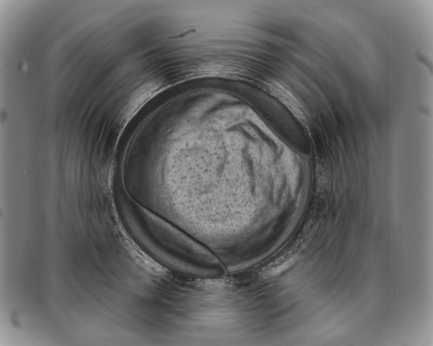X0000096680946200803041237