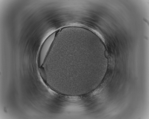 X0000096681007200803041236