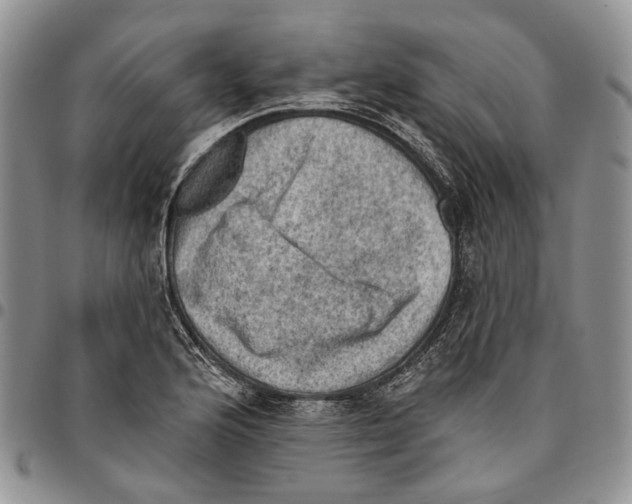 X0000096681176200803041234