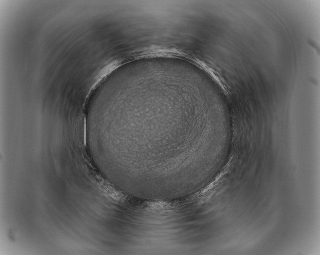 X0000096681219200803041234