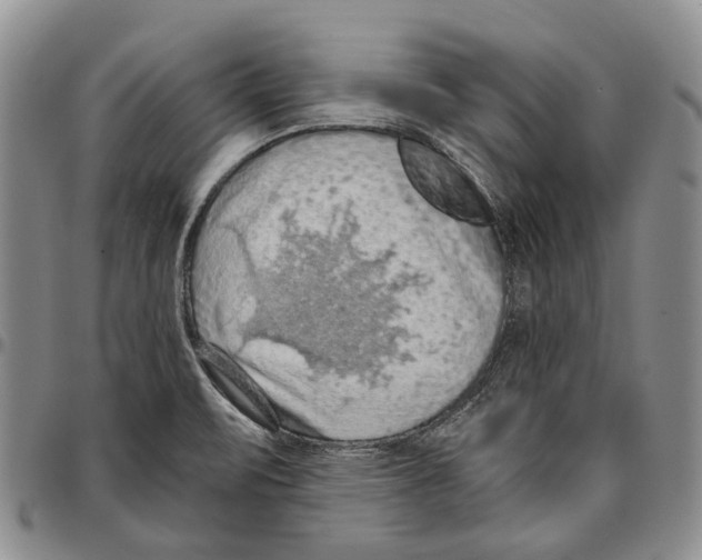 X0000096681471200803041231