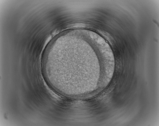 X0000096681475200803041231