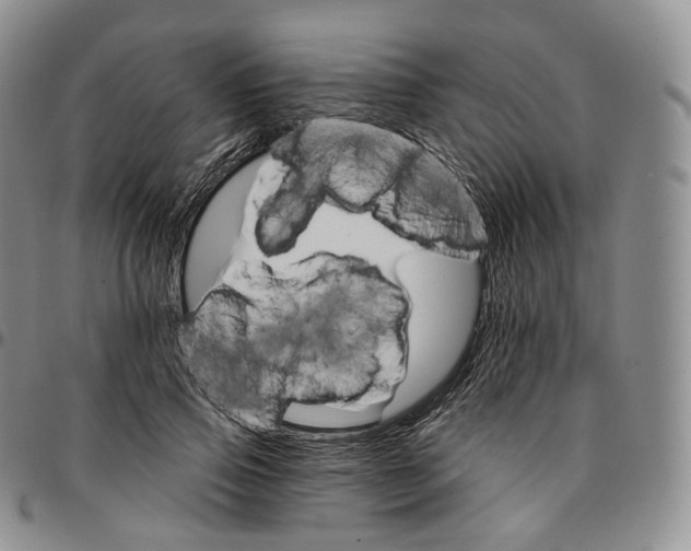 X0000096690741200803041300