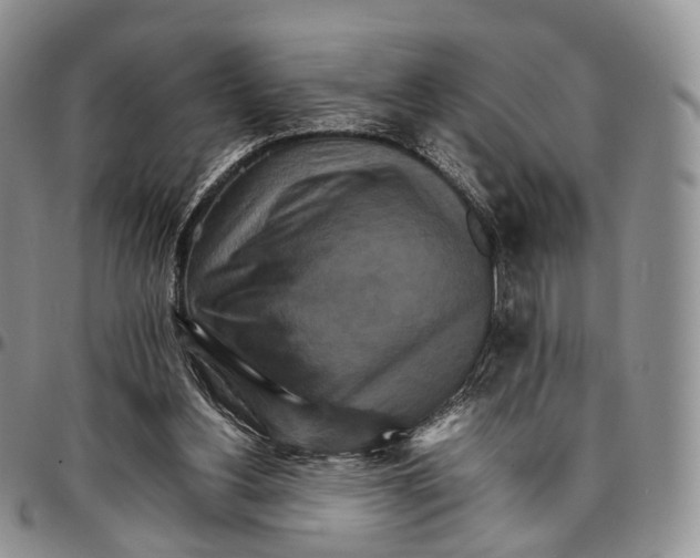 X0000096700156200803041328