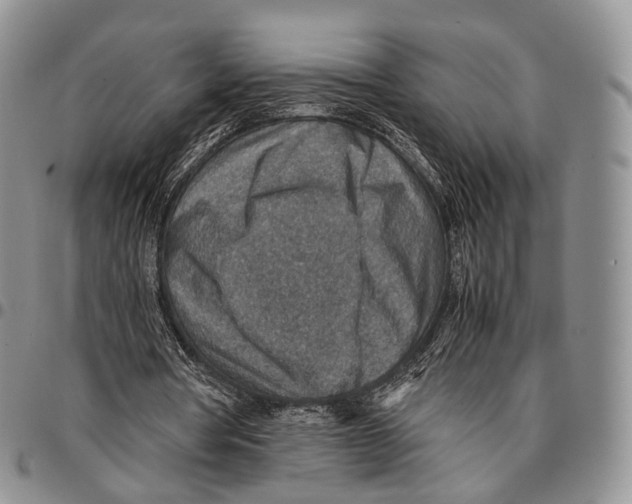 X0000096700386200803041325