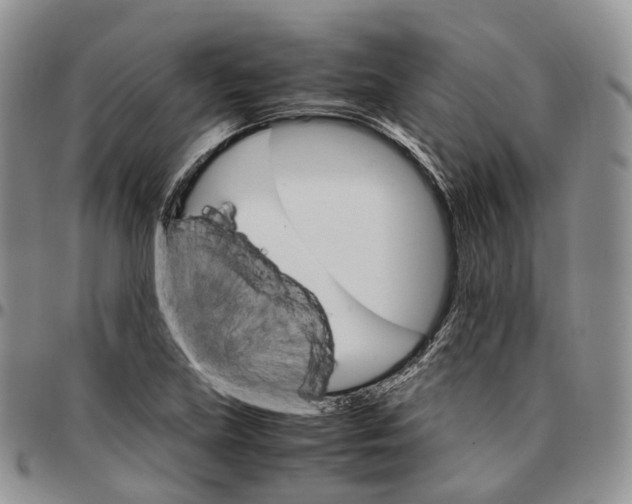 X0000096701219200803041314