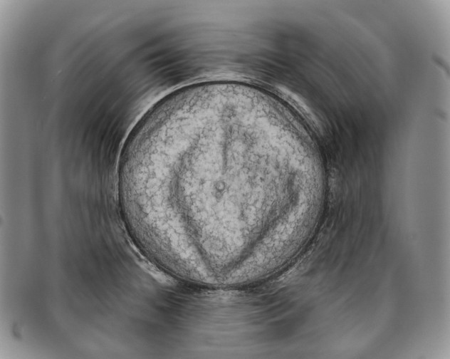X0000096701236200803041315