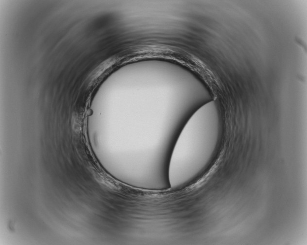 X0000096711017200802051032