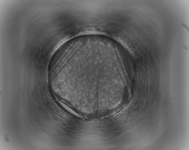 X0000096711173200803041335