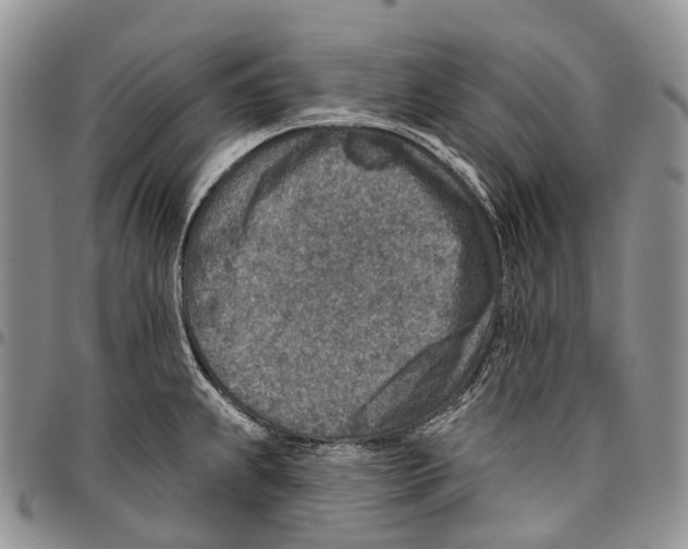 X0000096711239200803041334