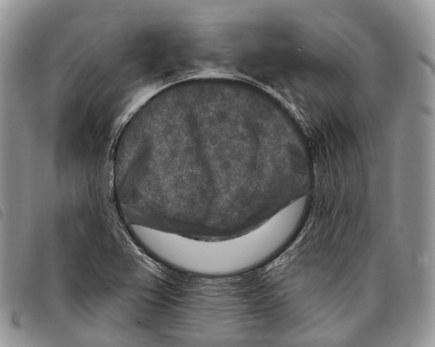 X0000096711367200803041332