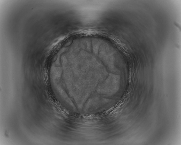 X0000096711398200803041332