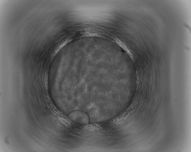 X0000096720386200803041406