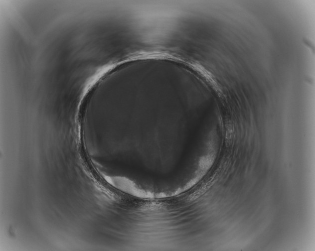 X0000096721414200803041352