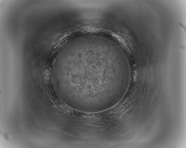 X0000096941397200802081155