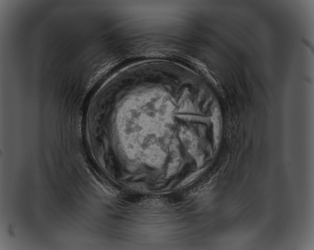 X0000096940299200802291039