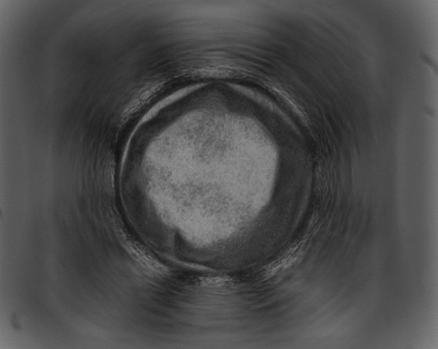 X0000096940446200802291037