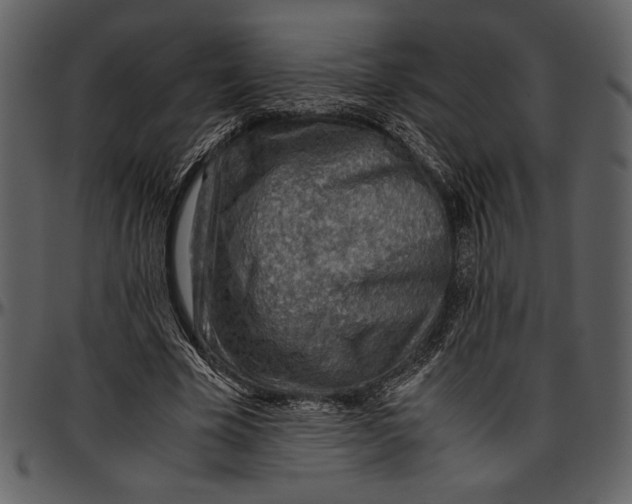 X0000096940585200802291035