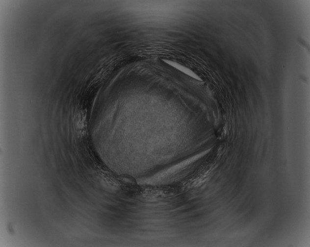 X0000096940818200802291030