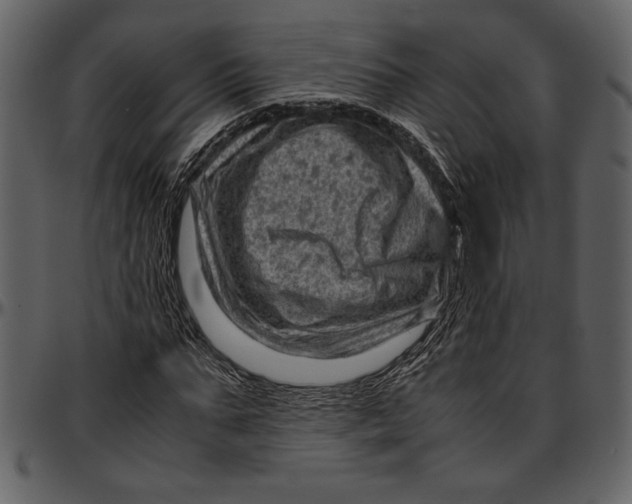 X0000096940871200802291030