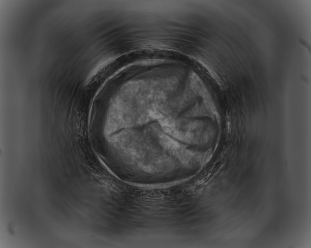 X0000096940919200802291029